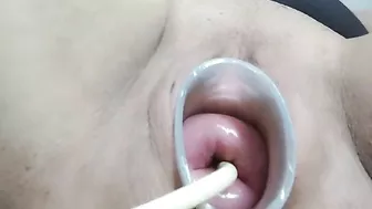 Maya Simons cervix injection and try many tampons penetration inside