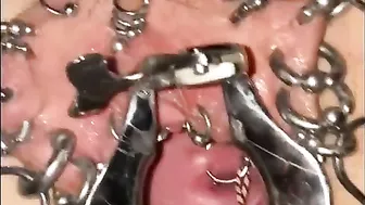 Extreme Cervix Sounding