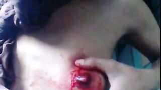 Self Chest Skin Cutting